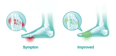OPPO METATARSAL FOOT PADS / 6782 – Unique Pharmacy